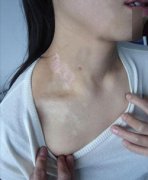  ��Щ���������֢״���ƣ�