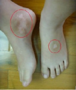  ����Ĳ���֢������Щ��