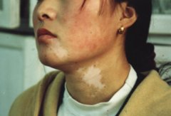  Ů�԰�����ʲôԭ������ģ�