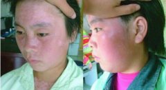  ���˰���ᴫȾ��������