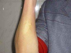  ��������Ҫע����Щ��ʳ���⣿