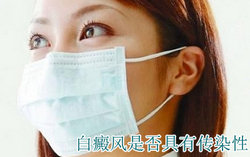 白癜风会不会传染 白癜风会不会传染