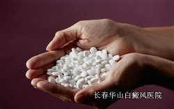 白癜风的治疗遵循什么原则 白癜风的治疗遵循什么原则
