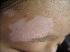 �������ƶ�ͯ����Ч�����