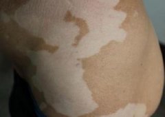 �������粡������Щ