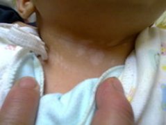 ��ͯ����Ӧ��������