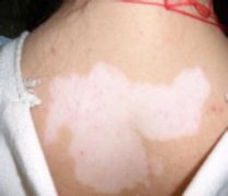 ��ͯ���������Ҫע��ɶ