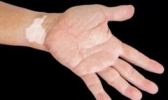 Ů�԰���֢״�ص�