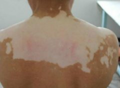 Ԥ��������ʲô�ð취��