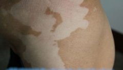 ���综���ʺϳԵ�ʲô����