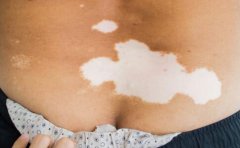 ���ϰ���֮����ʲô��Ҫע�����