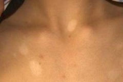 ���ϰ��粻���ԳԺ�����ʳ��