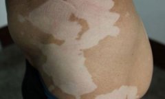 ���ڰ��综�߶���Ҫ�˽⵽ʲô��