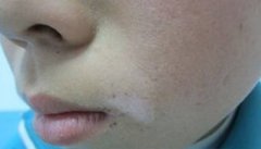 ���ڰ��综�������ж���Ҫȥע���ʲô��