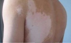 �����Եİ��综��������Ҫע��Щʲô��