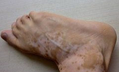 ���˰��绹��ʲô����Ƥ������