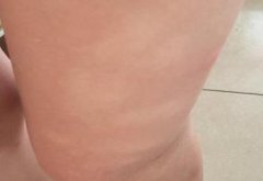 ��ô���ư���ķ�����