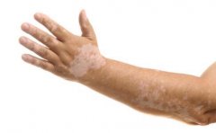 ����ʲôԤ������ķ�����